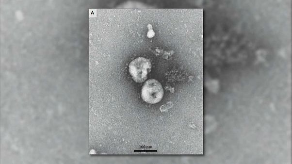 Cientistas belgas estudam anticorpo contra Covid-19 | Euronews