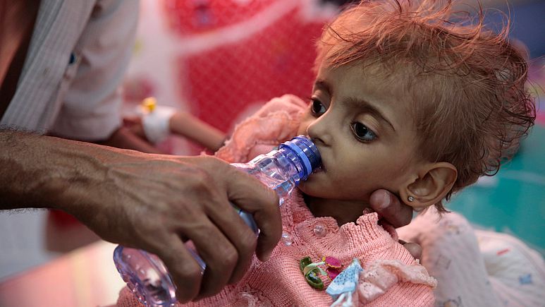 “Yemenlilerin yeterince içme suyu bile yok”