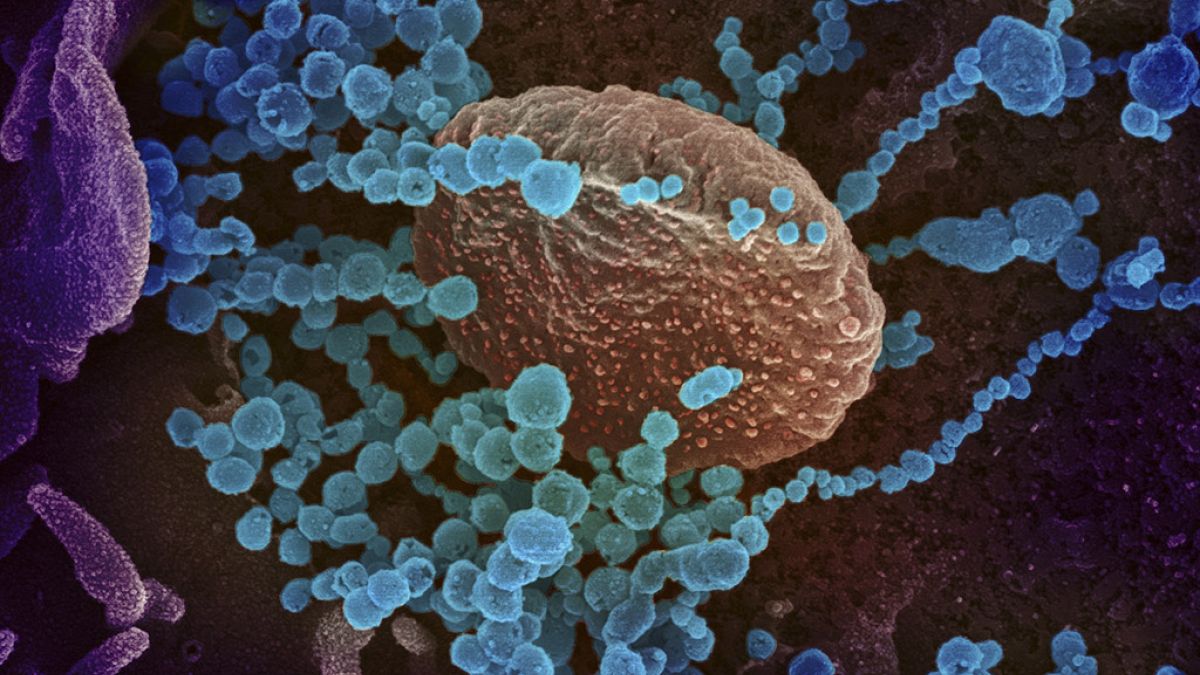 Le nouveau coronavirus (en bleu) sort de cellules cultivées en laboratoire. Le virus a été obtenu à partir d'un patient américain.