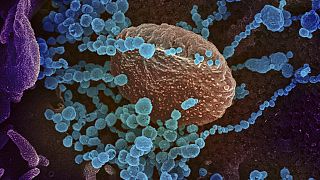 The new coronavirus (in blue) arises from cells grown in  laboratory. Virus obtained from an American patient.