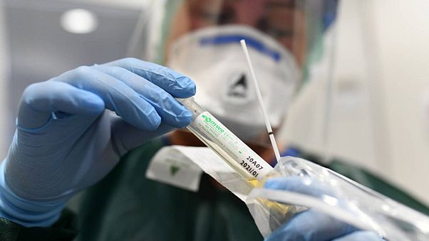 Almanya nisan ayında 100 bin kişilik geniş çaplı testle koronavirüs bağışıklık haritasını çıkaracak Almanya nisan ayında 100 bin kişilik geniş çaplı testle koronavirüs bağışıklık haritasını çıkaracak