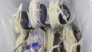 Virus Outbreak California Blood Donations