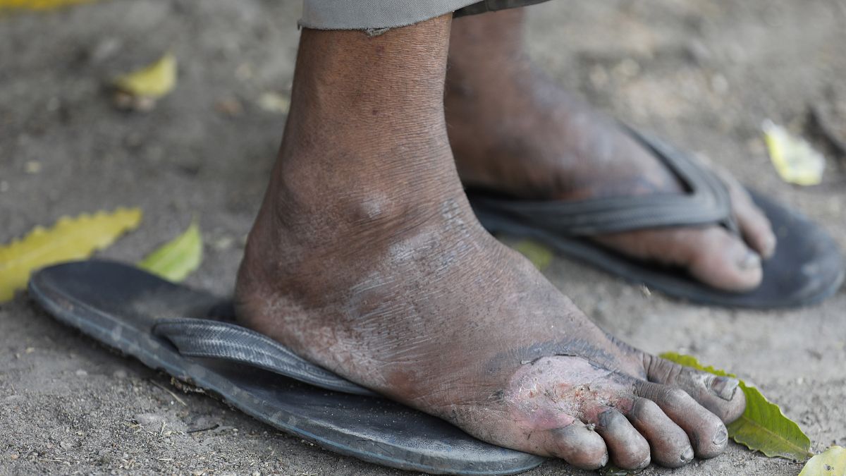 Hindistan'da hükümetin sokağa çıkma yasağı ilan etmesinin ardından işçiler köylerine dönmeye çalışıyor