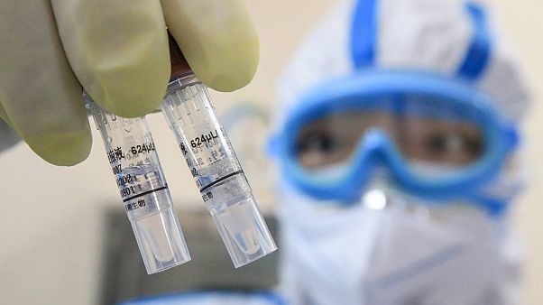 Çinli bilim insanları koronavirüse karşı 'oldukça etkili' antikor tedavisi geliştirdi Çinli bilim insanları koronavirüse karşı 'oldukça etkili' antikor tedavisi geliştirdi