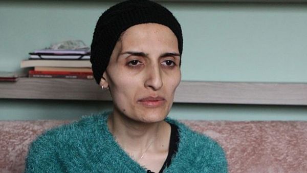 grup yorum un olum orucundaki uyelerinden helin bolek hayatini kaybetti euronews