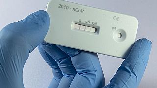 Ein Forscher in einem deutschen Labor zeigt einen Test auf Antikörper gegen das Coronavirus