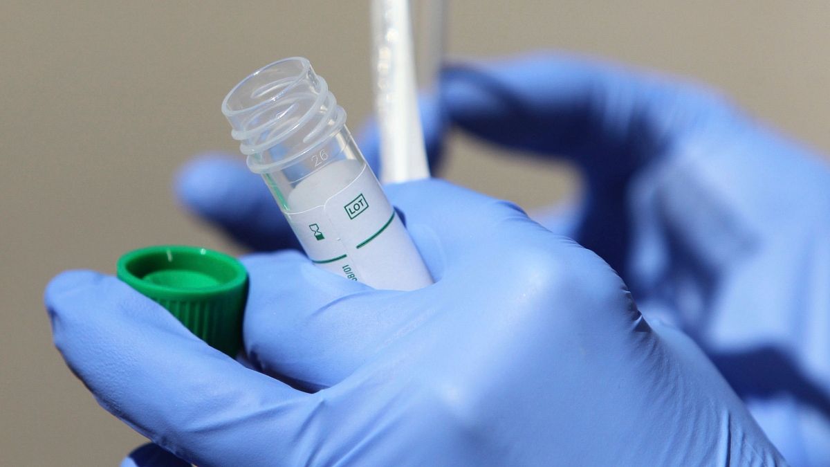 Des tests de fabrication française pourront détecter le coronavirus en 15 minutes