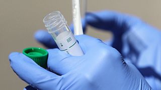 Francia desarrolla un test rápido para el coronavirus