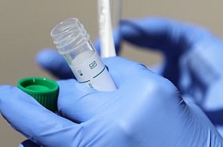 Teste revela contaminação por coronavírus em 15 minutos