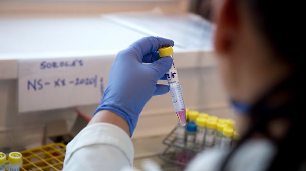 Koronavírus - A Nemzeti Népegészségügyi Központ Virológiai Laboratóriuma Koronavírus - A Nemzeti Népegészségügyi Központ Virológiai Laboratóriuma
