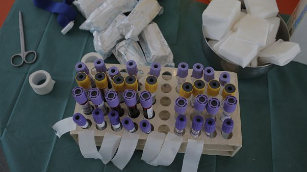 Ελλάδα: Δύο θάνατοι και 36 νέα κρούσματα COVID-19 εκ των οποίων τα 2 σε πύλες εισόδου Ελλάδα: Δύο θάνατοι και 36 νέα κρούσματα COVID-19 εκ των οποίων τα 2 σε πύλες εισόδου