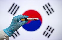 Güney Kore'de iyileştikten sonra yeniden pozitif çıkan Covid-19 hastalarının sayısı 141'e çıktı.