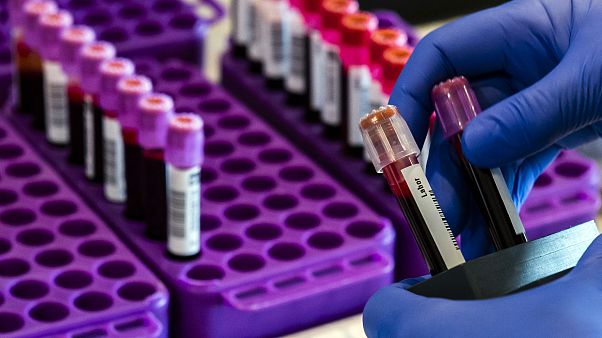 Wien: Schnelltest am Flughafen löst Quarantäne ab Wien: Schnelltest am Flughafen löst Quarantäne ab