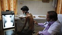Врач осматривает больного туберкулезом в Аллахабаде, Индия 24 марта 2014