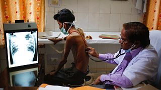 File, 2014 - a doctor examines a tuberculosis patient in a government TB hospital in Allahabad, India