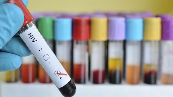 Uzmanlar uyarıyor: Covid-19'a karşı alınan önlemler AIDS hastalarının artışına neden olabilir Uzmanlar uyarıyor: Covid-19'a karşı alınan önlemler AIDS hastalarının artışına neden olabilir