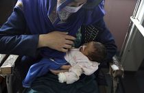 La mère et son bébé, rescapés de la tuerie dans une maternité de Kaboul - Afghanistan - le 13 mai 2020