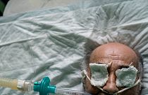 Dans un hôpital d'Ukraine, plongée dans la guerre de tranchées du coronavirus