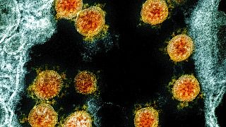 This electron microscope image shows Novel Coronavirus SARS-CoV-2 virus particles, orange, isolated from a patient. (NIAID/National Institutes of Health via AP)