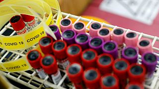 Araştırma: Covid-19'a karşı üretilen antikorlar kandan 2 ila 3 ay içinde siliniyor