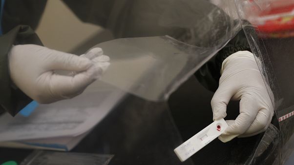 HDP'li bir milletvekilinin koronavirüs testi pozitif çıktı HDP'li bir milletvekilinin koronavirüs testi pozitif çıktı