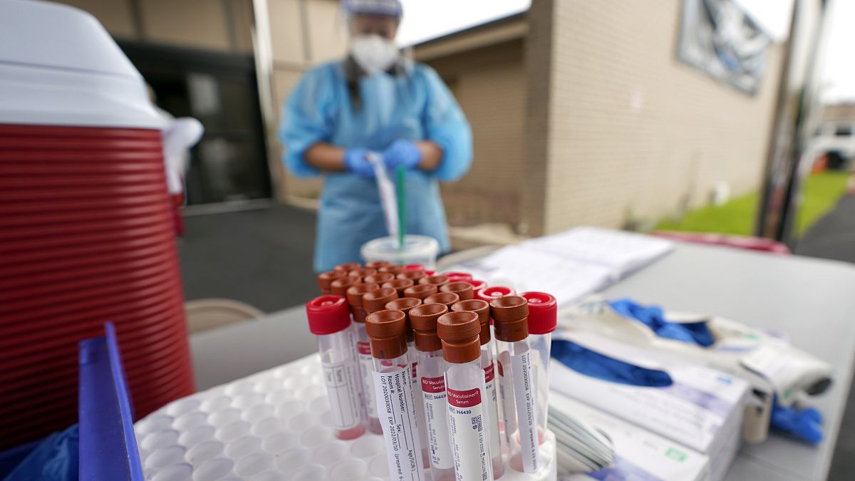 Test kits sit on a table at a United Memorial Medical Center COVID-19 testing site on June 26, 2020, in Houston, Texas.