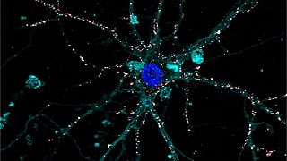 Ingrandimento a microscopio a fluorescenze di un neurone della retina (nucleo blu) e delle nanoparticelle polimeriche fotoattive (in rosso) adese alla sua membrana