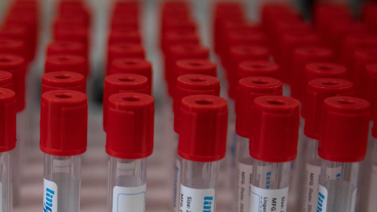 Derrière la recherche d’un vaccin contre le coronavirus se cache la bataille des brevets