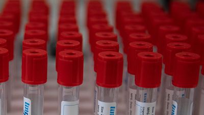 Derrière la recherche d’un vaccin contre le coronavirus se cache la bataille des brevets