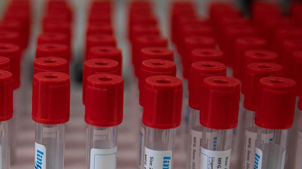 EU will künftigen Coronavirus-Impfstoff zum Allgemeingut machen EU will künftigen Coronavirus-Impfstoff zum Allgemeingut machen