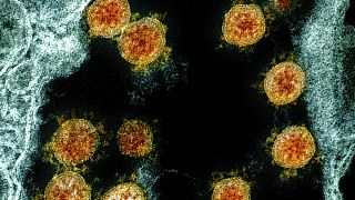 Novel Coronavirus SARS-CoV-2 virus particles, orange, isolated from a patient. Research released on Thursday, May 28, 2020 shows how dangerous the coronavirus is for current a