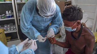 إجراء تحاليل تشخيص الإصابة بكوفيد-19 على أحد أعضاء مجموعة يانومامي العرقية في أرض سوروكوكو في البرازيل