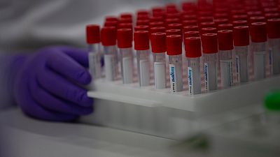 Covid-19 aşısının bir iki yılda bulunabilmesi mümkün mü?