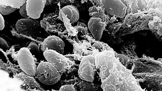 باکتری یرسینیا پستیس، عامل بیماری طاعون خیارکی