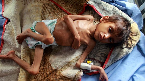 السعودية نيوز | 
    مرض وجوع وأطفال بأجساد هزيلة في مستشفى يمني بعد 6 سنوات من الدمار
