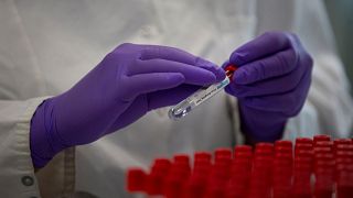 FILE: A lab technician puts a label on to a test tube while conducting research on coronavirus, COVID-19