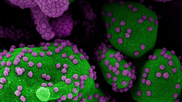 2020. július 2. Az amerikai Allergiás és Fertőző Betegségek Országos Intézetében (NIAID) készült delektronmikroszkópos, utószínezett kép SARS-CoV-2-vel fertőzött sejtekről 2020. július 2. Az amerikai Allergiás és Fertőző Betegségek Országos Intézetében (NIAID) készült delektronmikroszkópos, utószínezett kép SARS-CoV-2-vel fertőzött sejtekről