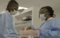 El Instituto científico Noguchi lidera la batalla contra la fiebre amarilla y el ébola en Ghana