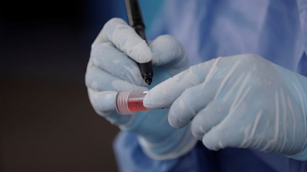 Koronavírustesztre levett vizsgálati mintát jelöl meg egy egészségügyi alkalmazott Koronavírustesztre levett vizsgálati mintát jelöl meg egy egészségügyi alkalmazott