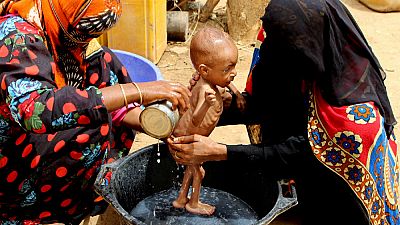 Las hambrunas ligadas a la pandemia amenazan a 7 millones de niños