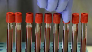Кровь доноров в лаборатории Имперского колледжа Лондона, где разрабатывают вакцину от коронавируса.