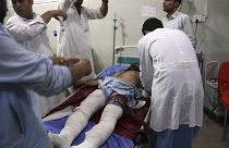 Afganistan'ın Celalabad kentinde bir cezaevine yönelik düzenlenen saldırıda onlarca kişi yaralandı