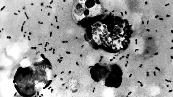 Yersinia pestis isimli bakteri Yersinia pestis isimli bakteri
