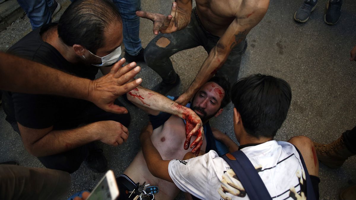 أحد الجرحى في احتجاجات الثامن من آب/أغسطس في بيروت 