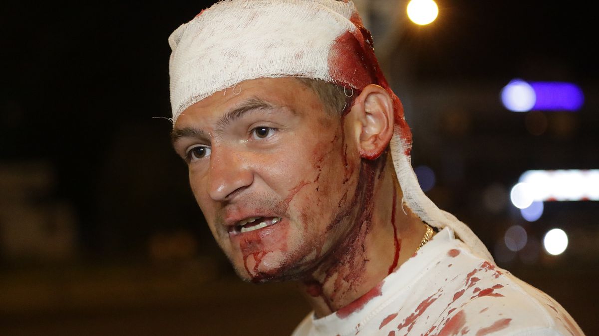 Демонстрант, раненный в столкновениях. Минск, 10 августа 2020