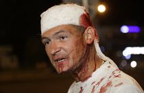 Демонстрант, раненный в столкновениях. Минск, 10 августа 2020