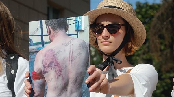 Belarus'un başkenti Minsk'te bir kadın protestolar sırasında polis şiddetine uğradığını iddia ettiği arkadaşının fotoğrafını gösteriyor Belarus'un başkenti Minsk'te bir kadın protestolar sırasında polis şiddetine uğradığını iddia ettiği arkadaşının fotoğrafını gösteriyor
