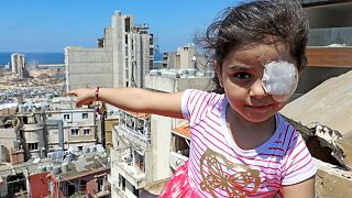 سما الحمد تلقت إصابة بعينها خلال انفجار مرفأ بيروت بعد أسابيع من احتفالها بعيد ميلادها السادس