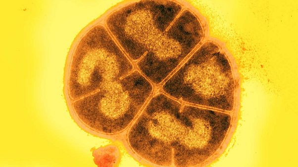Deinococcus Deinococcus