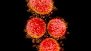 Partículas del virus del SARS-CoV-2, aisladas de un paciente.